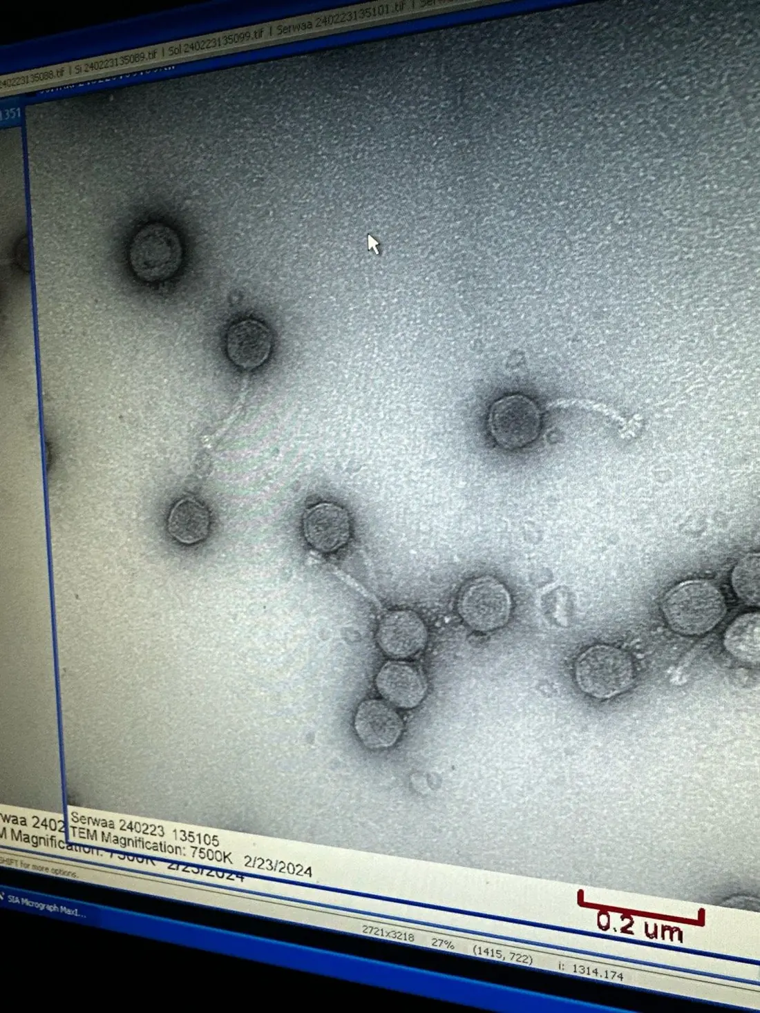 Transmission electron micrograph of phage Serwaa